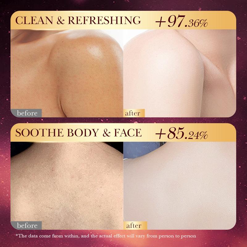 Luxury Skincare Oil - SADOER Essential Oil Soap Rose Cherry